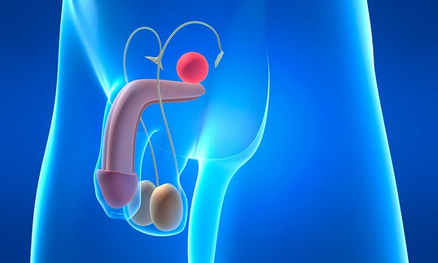 oedeem van de prostaat met prostatitis
