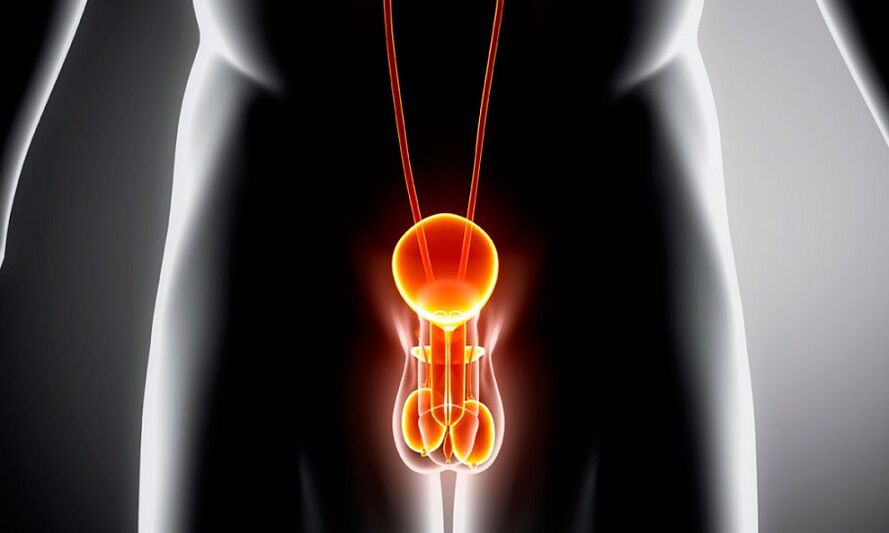 ontstoken uritorinair systeem voor prostatitis